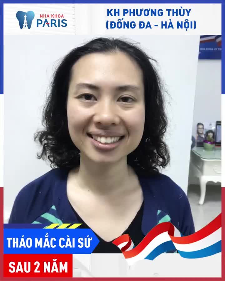Niềng Răng Tuổi 35 - Tưởng "Không Hiệu Quả" lại "Hiệu Quả Không Tưởng"