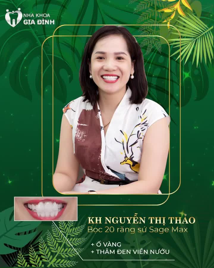 RĂNG SỨ CHỈ BỀN ĐẸP KHI CHỌN NHA KHOA UY TÍN, ĐÁNG TIN CẬY NHƯ NHA KHOA GIA ĐÌNH
