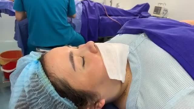 Sửa Mũi Hỏng đẹp ngay trên bàn mổ  Mời cả nhà cùng ngắm nhìn