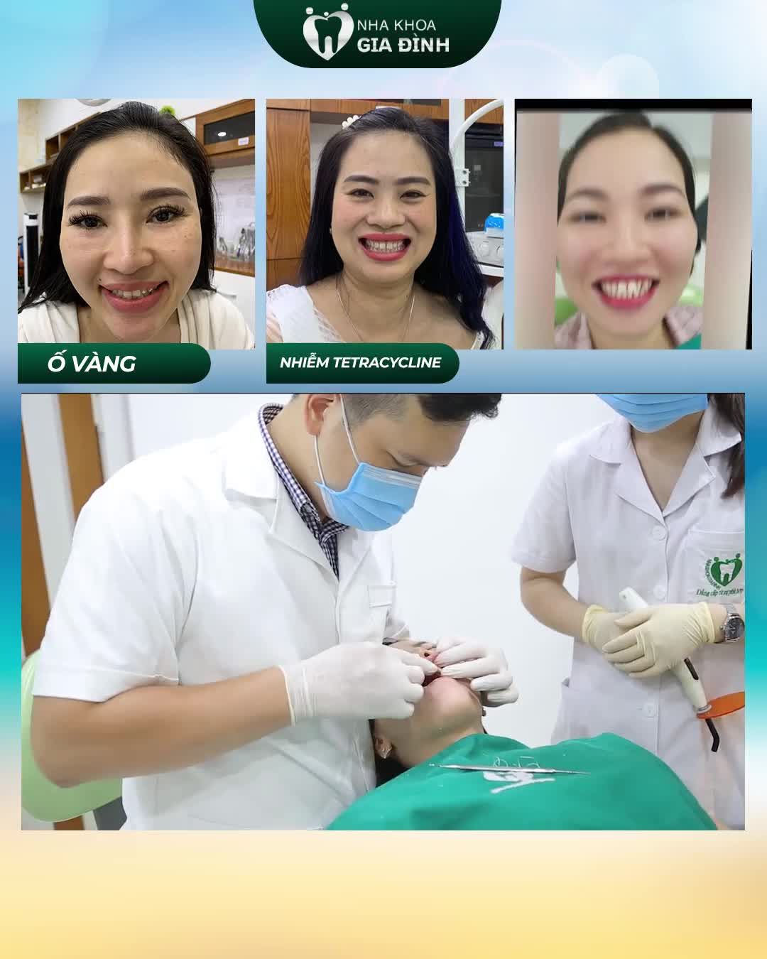 THẨM MỸ RĂNG: TRẮNG ĐẸP TỰ NHIÊN – ĂN NHAI TRỌN ĐỜI