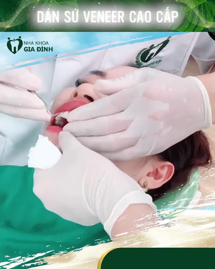Thẩm mỹ răng KHÔNG ĐAU - KHÔNG MÀI NHỎ với Dán sứ Veneer