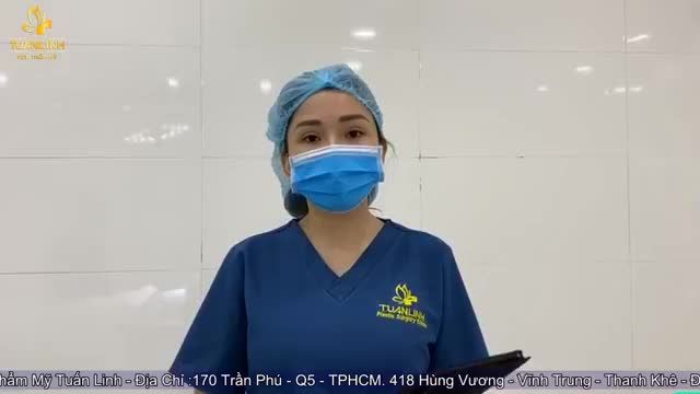 Case Nâng mũi Siêu cấu trúc Surgiform vừa xong tại Tuấn Linh nè cả nhà ơi