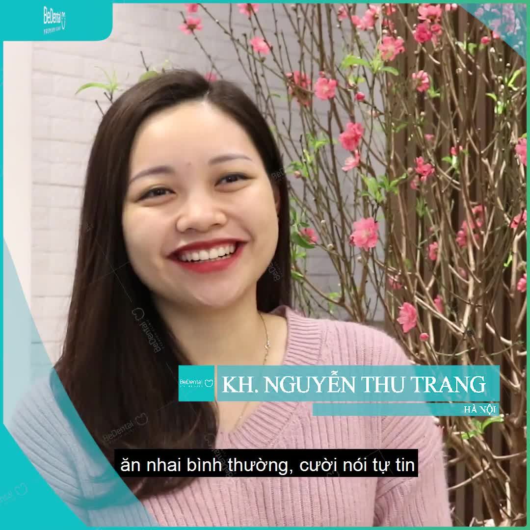 RĂNG THƯA chỉ còn là quá khứ