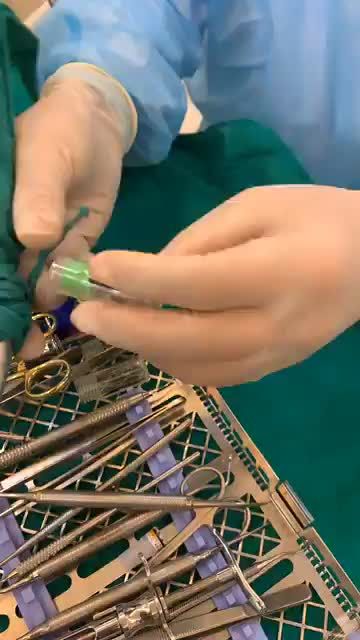 TIN ĐƯỢC KHÔNG - CẤY GHÉP 1 LẦN 3 TRỤ IMPLANT CỦA MỸ