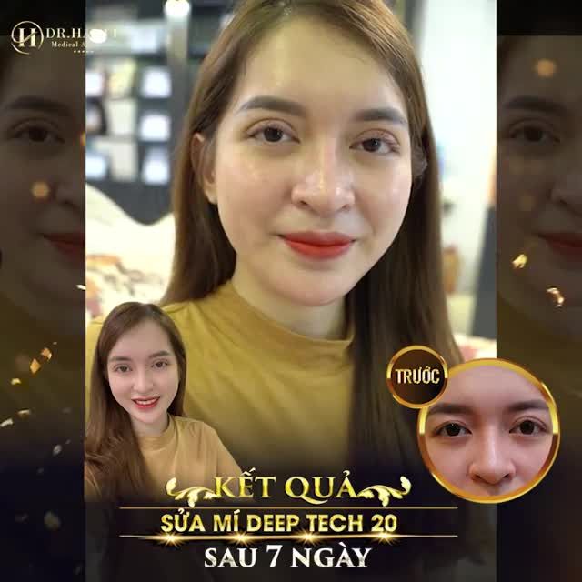 HÌNH ẢNH MỘC NHẤT CÓ THỂ