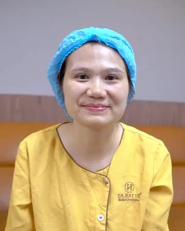 Kết quả nâng cung mày sau 30p tại Dr.Hải Lê