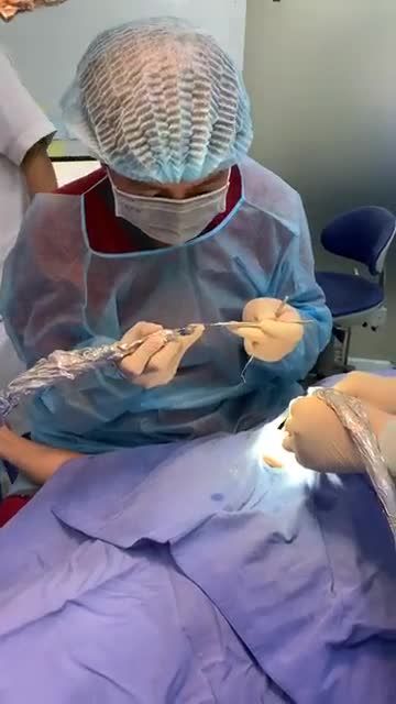 Bs Kangnam thực hiện cấy implant Muốn làm đẹp an toàn hãy tới với kangnam