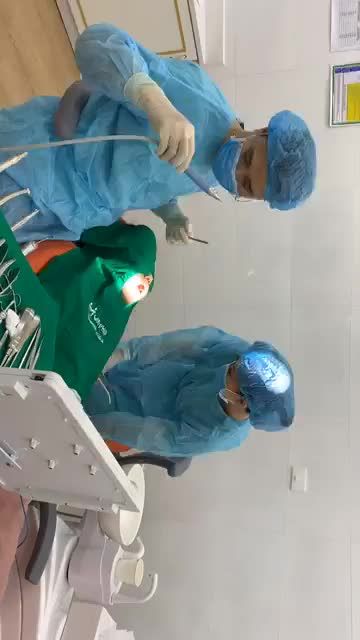 Ca nhổ răng 8 hàm trên hàm dưới mọc lệch
