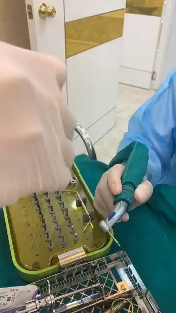 CẤY GHÉP 1 LẦN 2 TRỤ IMPLANT HÀN QUỐC - PHỤC HÌNH RĂNG HOÀN HẢO