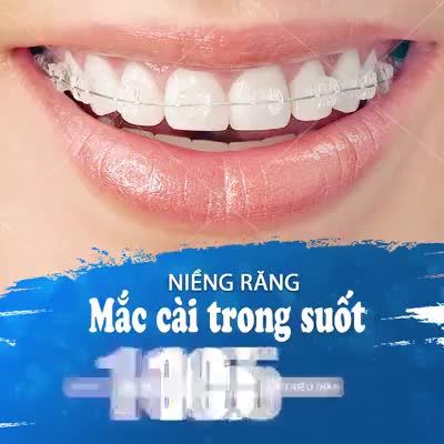 NIỀNG RĂNG PHA LÊ TRONG SUỐT - TỰ TIN CƯỜI CUỐN HÚT Chỉ với 10,5tr/hàm