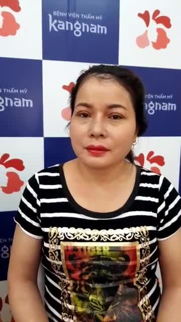 Nâng Mũi + Cắt mí HỒI XUÂN nhan sắc bất ngờ