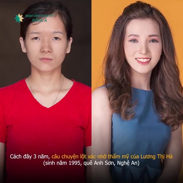 Từng bị cả gia đình người yêu miệt thị "cái đồ mắt lươn"