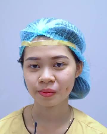 Sở hữu má lúm đồng tiền đẹp tự nhiên, duyên dáng, an toàn, không để lại sẹo chỉ sau 20 phút !!