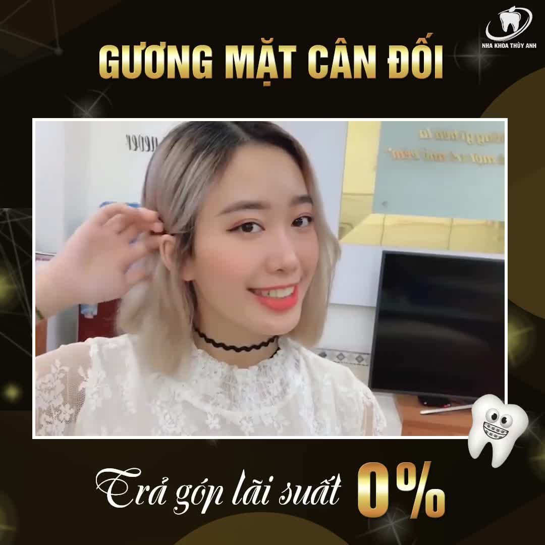 THÁNG NĂM KHÔNG TRỞ LẠI NGẠI GÌ CHƯA NIỀNG RĂNG?