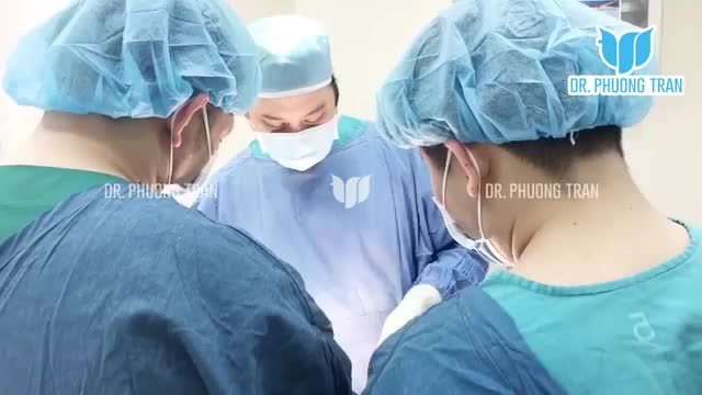 NÂNG MŨI CẤU TRÚC SỤN SƯỜN TỰ THÂN SURGIFORM TẠI BỆNH VIỆN