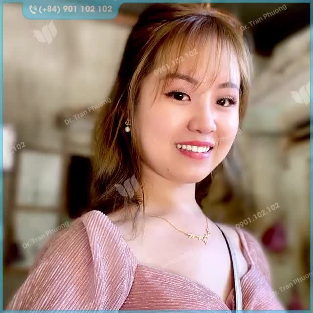 NÂNG MŨI LÀ CẢ MỘT HÀNH TRÌNH - KHÔNG PHẢI NGÀY MỘT NGÀY HAI...