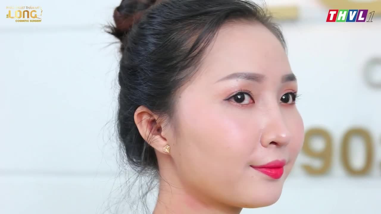 .NÂNG MŨI CẤU TRÚC ̶5̶̶0̶̶T̶̶r̶̶i̶̶ệ̶̶u̶ chỉ còn 40tr