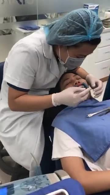KH Bùi Thị Thanh Hoà , sn 1996 , địa chỉ quận Cầu Giấy chỉnh nha MCSTB tại nha khoa Paris Quang Trung- HN do bs Hoa thực hiện
