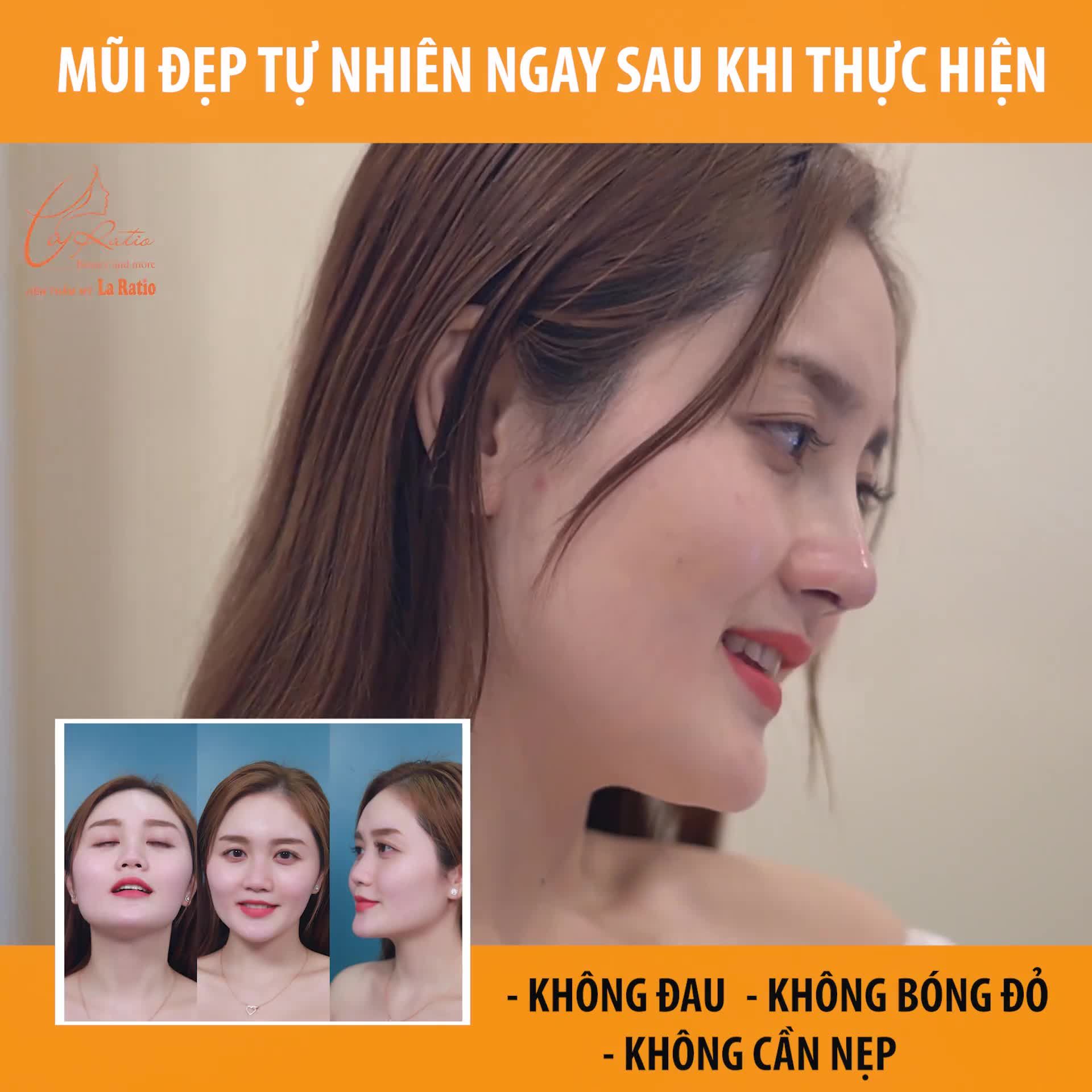 MŨI KHÔNG CHỈ ĐẸP TỰ NHIÊN NGAY SAU KHI VỪA THỰC HIỆN MÀ CÒN PHẢI AN TOÀN.