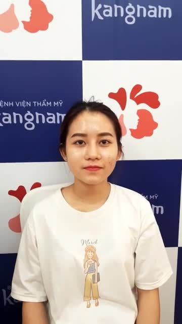 MŨI ĐẸP XUẤT SẮC - Cao, thon gọn với NÂNG MŨI CẤU TRÚC 4D