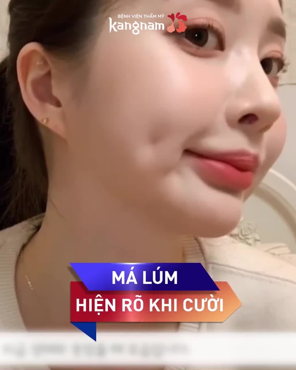 Má lúm càng nhìn càng duyên