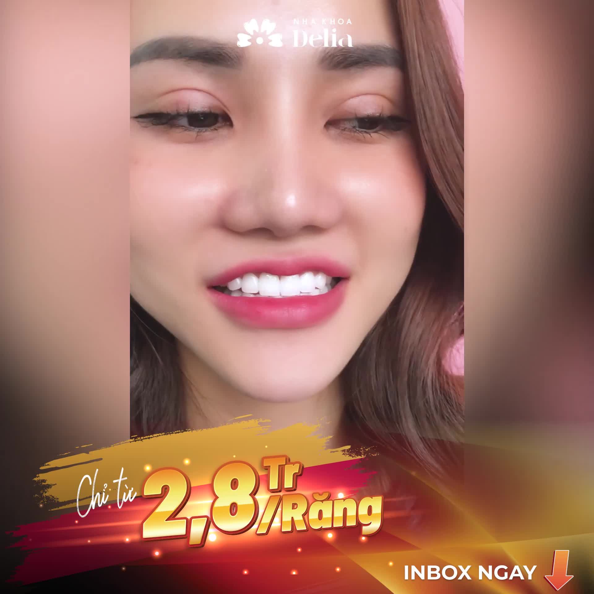 Bạn có tin đây là nụ cười của khách hàng đã từng thẩm mỹ răng sứ hỏng?