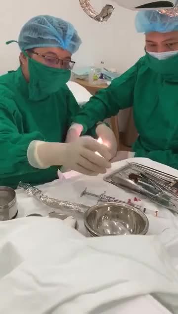 QUÁ TRÌNH NHỔ RĂNG KHÔN CÔNG NGHỆ HIỆN ĐẠI