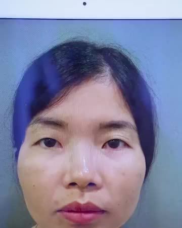 Là phụ nữ đừng từ chối cơ hội để mình đẹp hơn mỗi ngày. Mời cả nhà cùng chiêm ngưỡng kết quả cắt mí Mani Open Deep 5D hoàn hảo tại Dr.Hải Lê.!