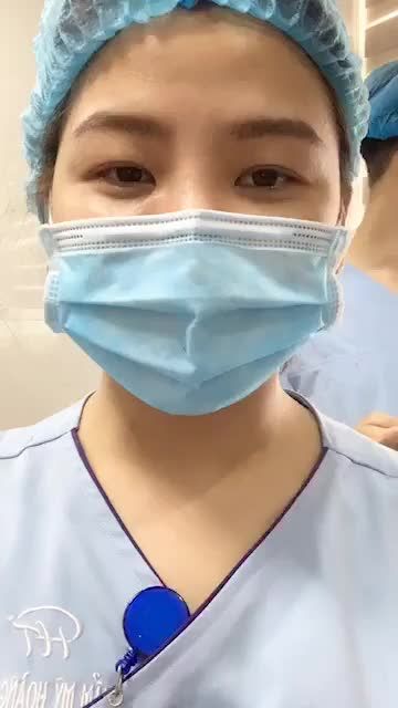 Sống mũi thấp ngắn, đầu mũi tròn không còn là vấn đề sau nâng mũi Sline! Ca mũi số 65