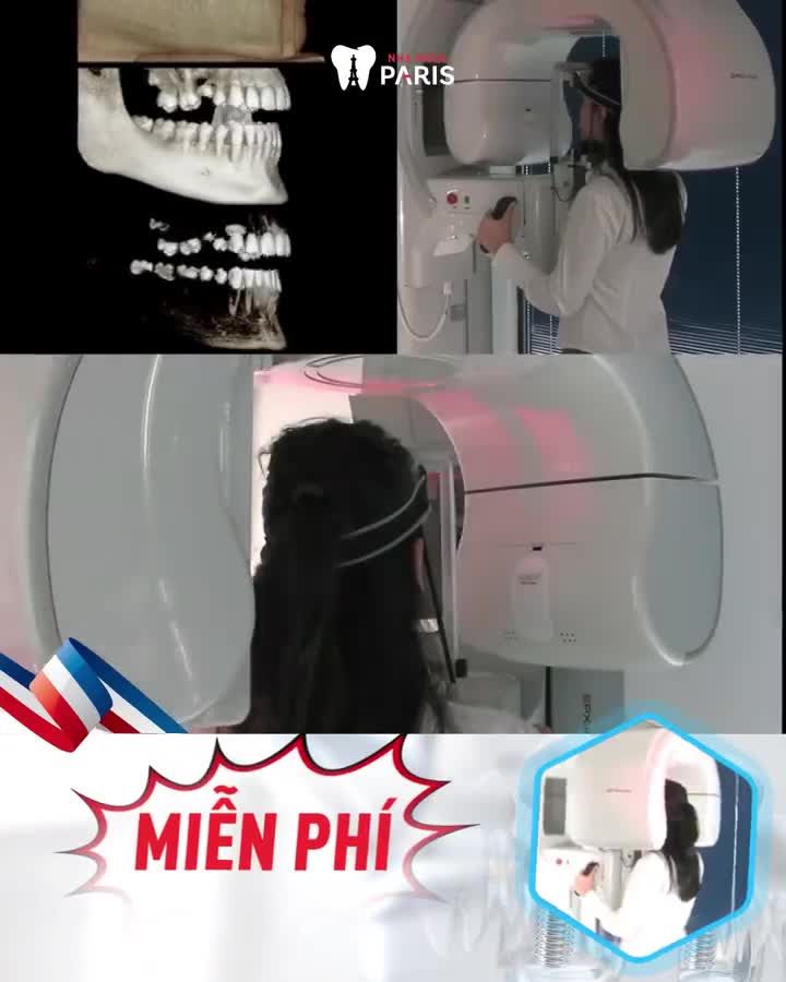 Ám ảnh vì MẤT 1 RĂNG MẤT NHIỀU RĂNG ❗️MẤT RĂNG TOÀN HÀM ?