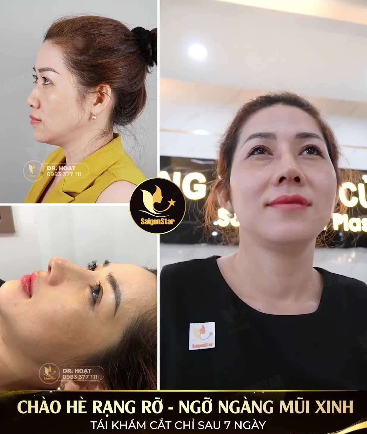 CHÀO HÈ RẠNG RỠ - NGỠ NGÀNG MŨI XINH