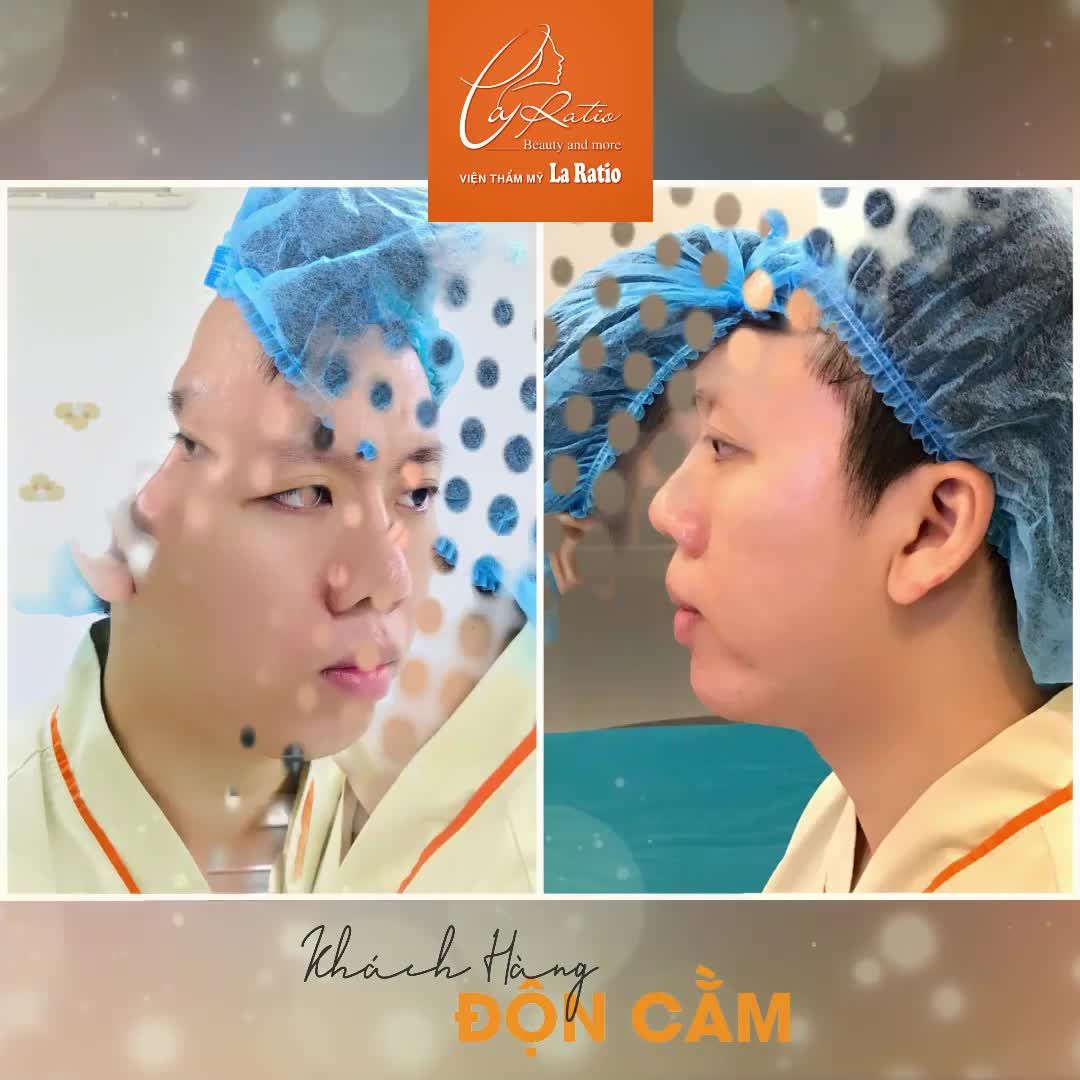 ĐỘN CẰM TỪ LÂU ĐÃ KHÔNG CÒN CHỈ DÀNH CHO PHÁI ĐẸP