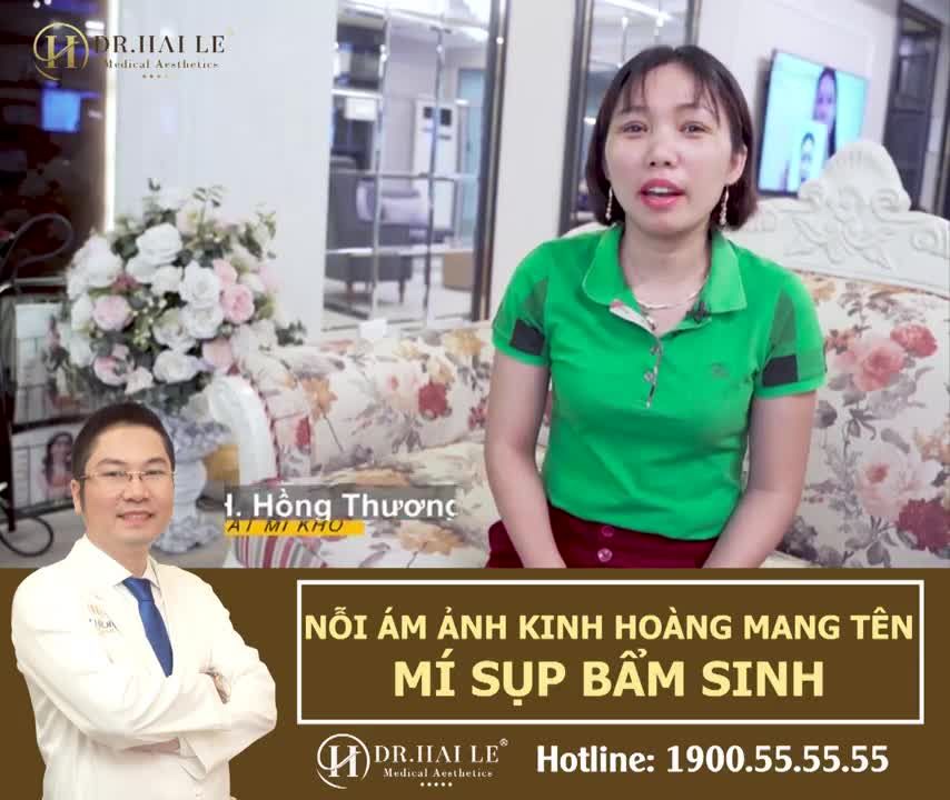 VÌ SAO SỤP MÍ BẨM SINH NÊN XỬ LÝ SỚM?