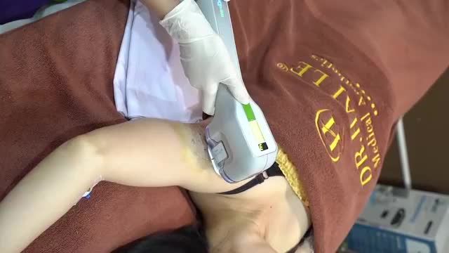 Cùng xem live stream để nghe Bác sĩ tư vấn trực tiếp về phương pháp trị hôi nách bằng Miradry 1 lần duy nhất