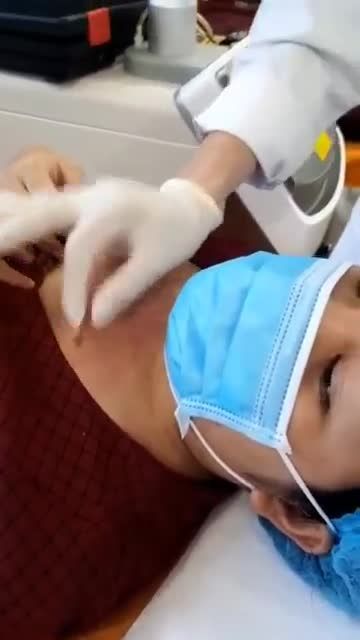 SẸO LỒi to, ngứa ngáy, ảnh hưởng đến thẩm mỹ điều trị như thế nào?