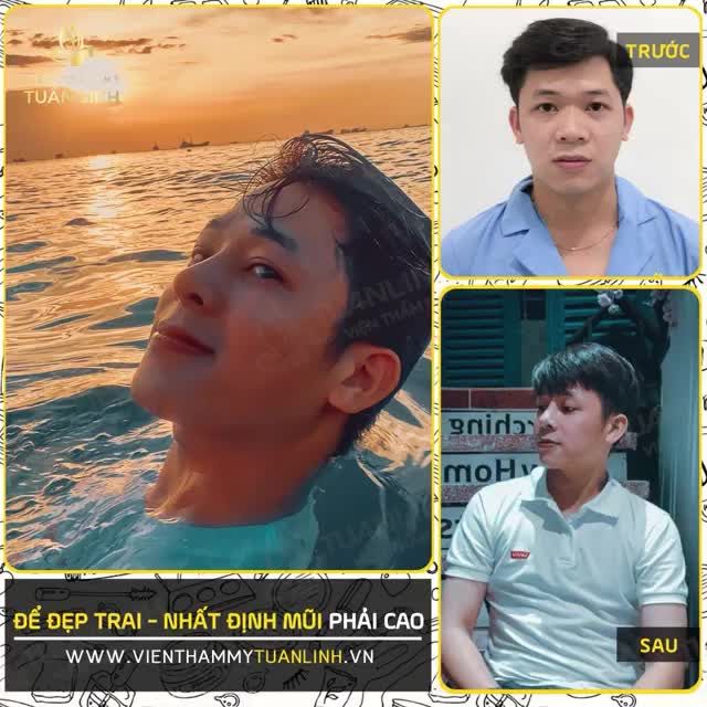 ĐỂ ĐẸP TRAI - NHẤT ĐỊNH MŨI PHẢI CAO