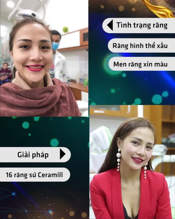 THẨM MỸ RĂNG – CHÌA KHÓA CHO NỤ CƯỜI TỎA NẮNG