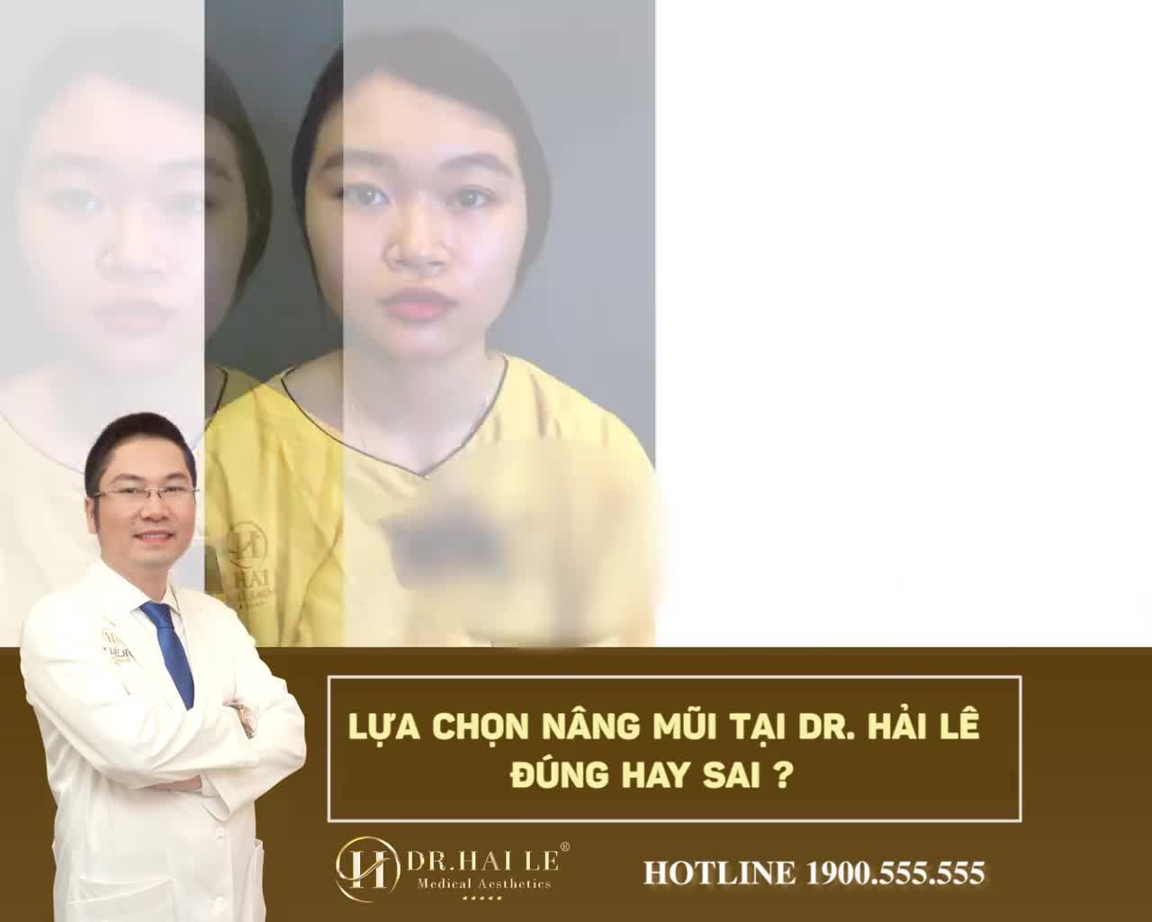 HOÀN TOÀN HÀI LÒNG VỚI NÂNG MŨI DEMI 5D TẠI DR.HẢI LÊ‼️