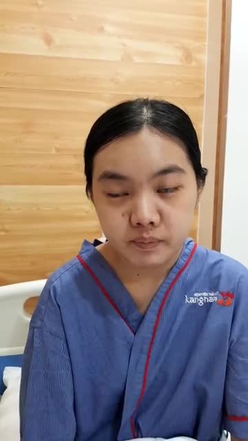 Hàm hô nặng phía trên ,cằm lẹm sâu vào trong