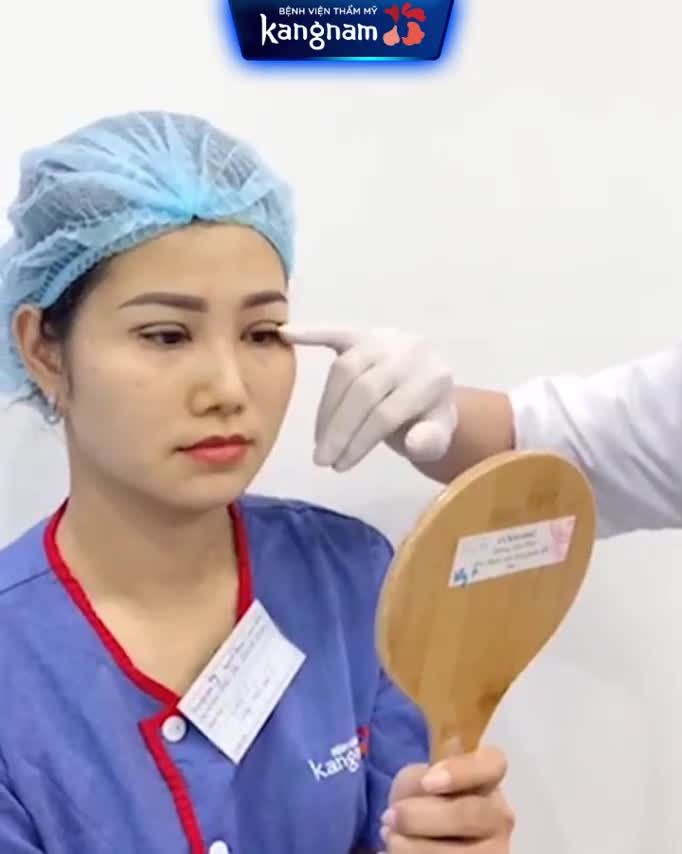 Vừa Cắt Mí xong - Có sưng không?