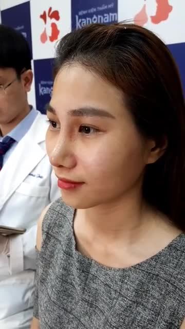 Chỉ sau 10 ngày - Nâng mũi cấu trúc 4D - Mũi lên dáng SLine Chuẩn ĐẸP miễn chê