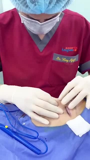 Mũi tẹt, hếch, ngắn..Mắt 1 mí, da chùng, mỡ thừa..Phải làm sao