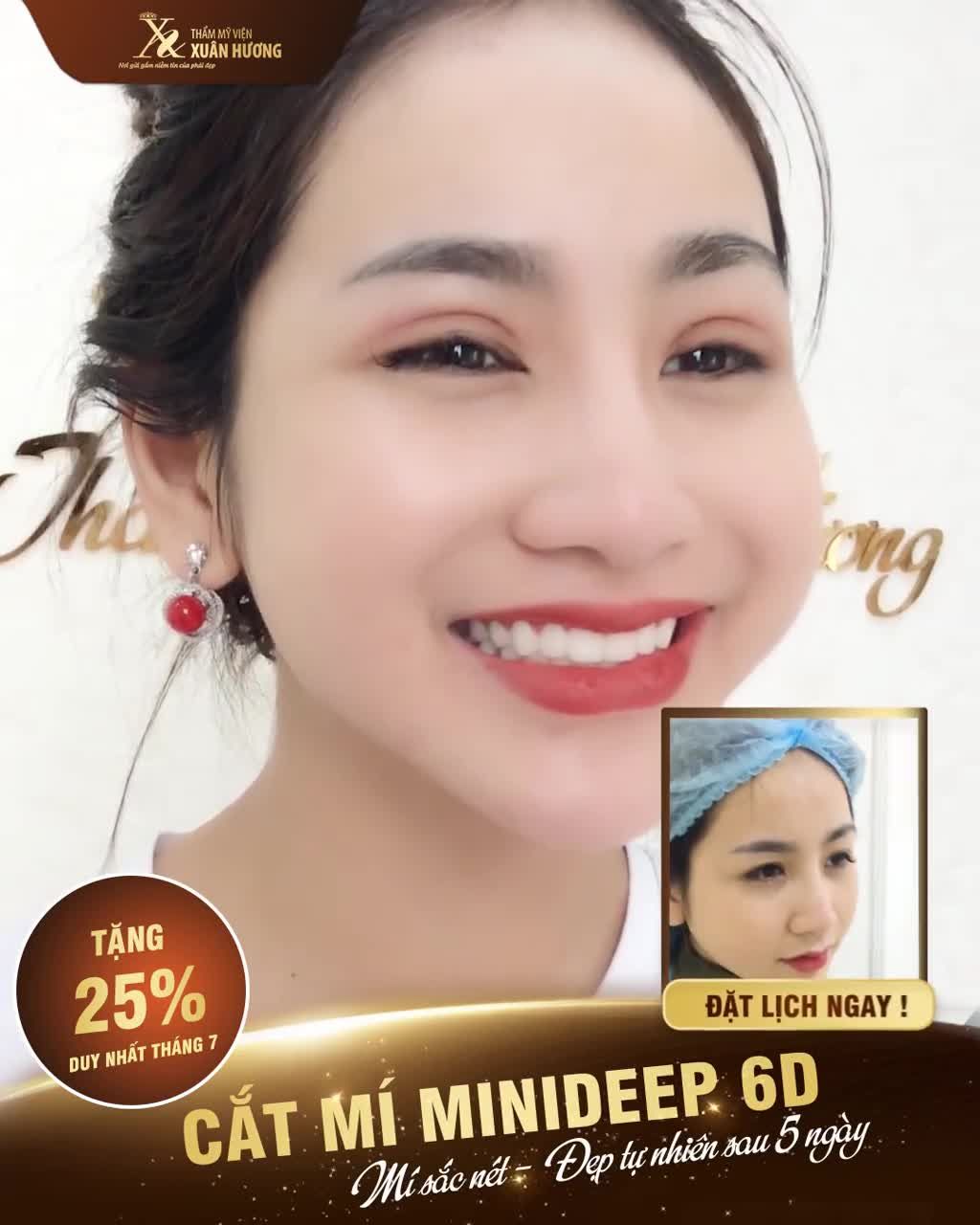 CHỈ SAU 5 NGÀY - CÓ NGAY NẾP MÍ SẮC NÉT ĐẸP TỰ NHIÊN