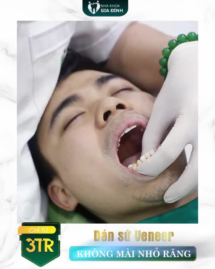 MUỐN RĂNG ĐẸP MÀ BỀN CHẮC, ĂN NHAI TRỌN ĐỜI THÌ CHỌN NHA KHOA GIA ĐÌNH