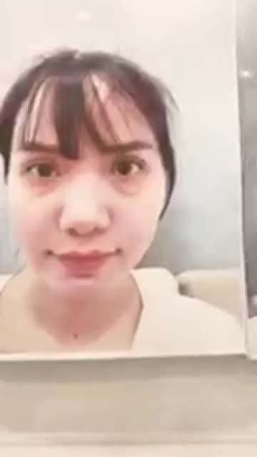 NÂNG MŨI CẤU TRÚC GIÚP MŨI TO THON GỌN VÀ THANH THOÁT HƠN