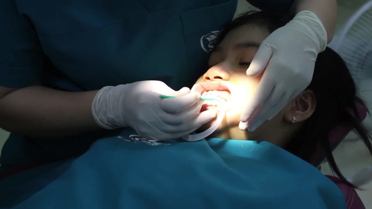 NIỀNG RĂNG LỢI GÌ