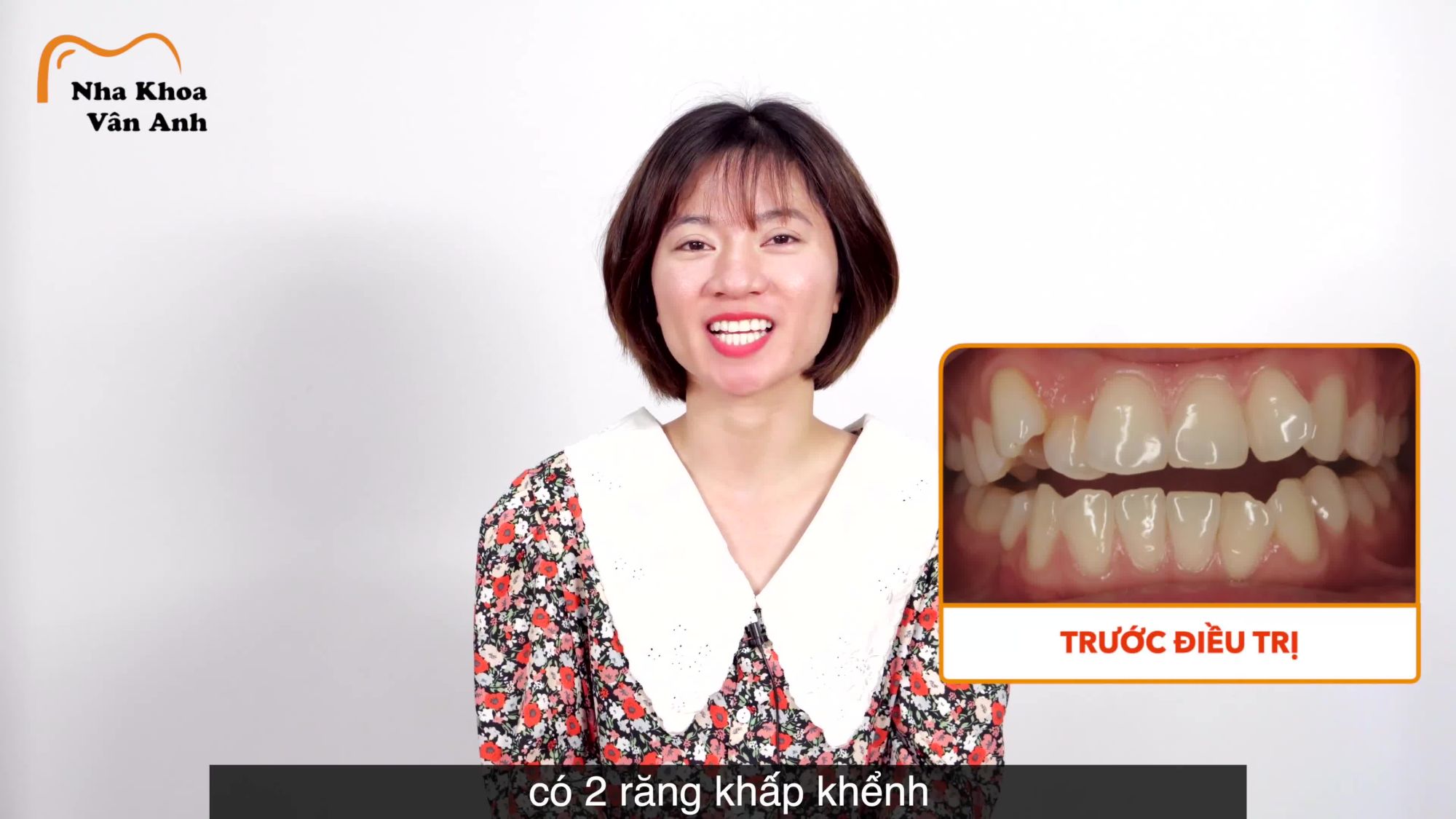 "Răng đẹp rồi, tháo niềng đi, răng đẹp lắm rồi, mọi người thường khen mình như vậy"