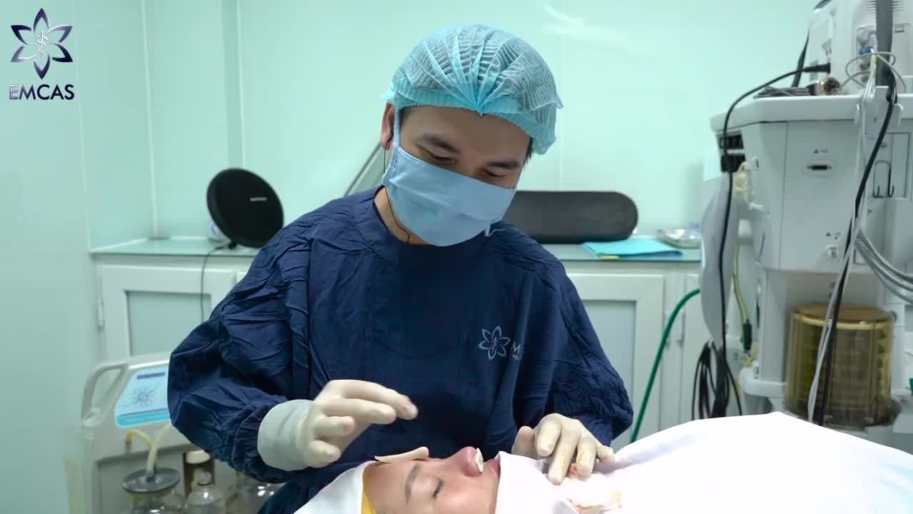 SỤN SURGIFORM - GIẢI PHÁP TỐT CHO NÂNG MŨI TÁI CẤU TRÚC