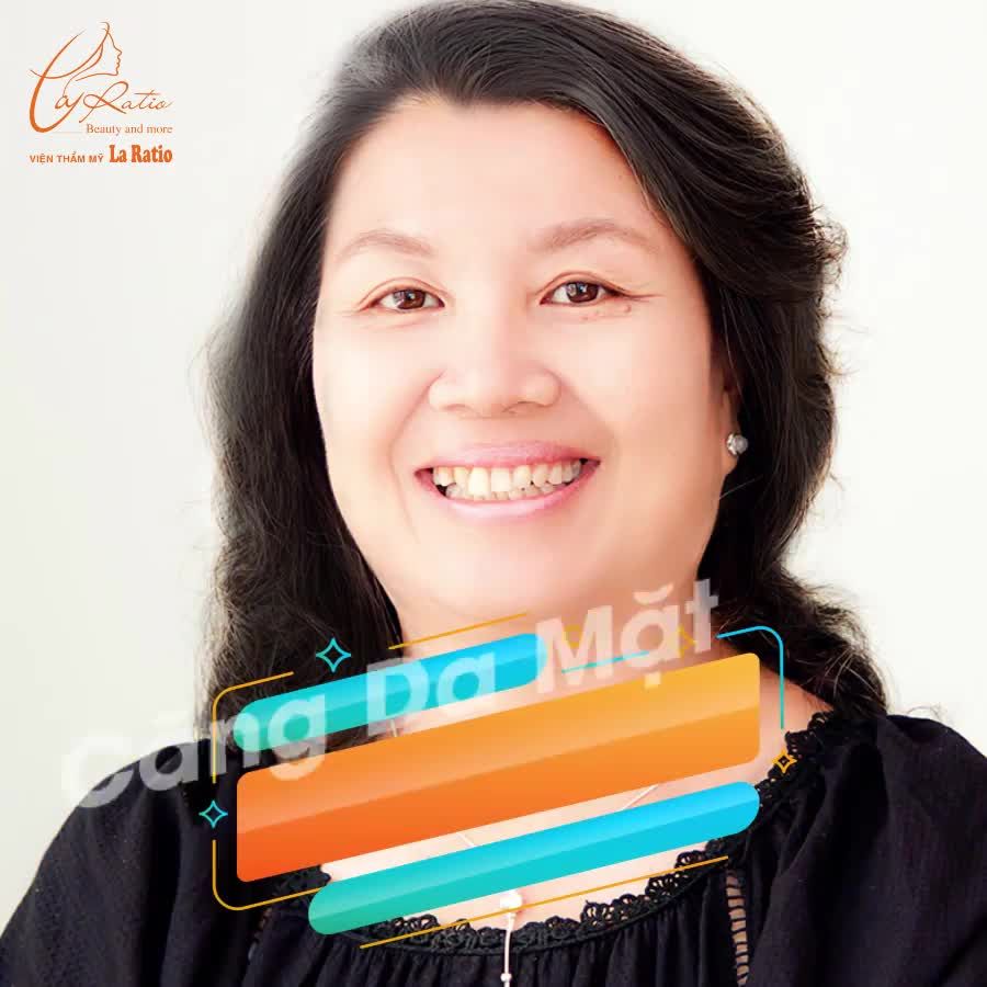 CĂNG DA BẰNG CHỈ XTRA YOUNG – LÀM MỘT LẦN ĐẸP ĐẾN 10 NĂM