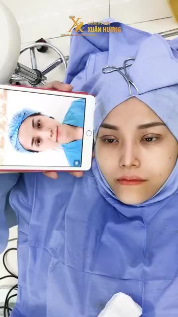 THẨM MỸ MẮT KHÓ ĐẾN ĐÂU - ĐÃ CÓ BÁC SĨ HÀNG ĐẦU TẠI TMV XUÂN HƯƠNG XỬ LÝ TRIỆT ĐỂ CẬN CẢNH CA CẮT MÍ VỪA THỰC HIỆN XONG